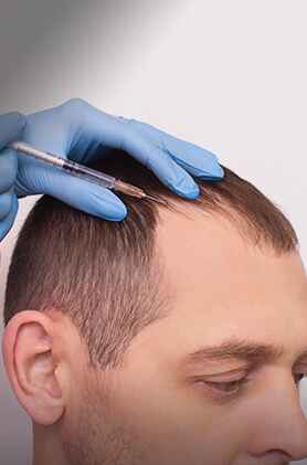 PRP treatment, platelet-rich plasma therapy, hair and skin rejuvenation, Anudhi Clinic, Chennai