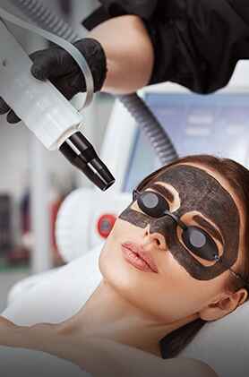 Carbon peel treatment, advanced skin care procedure, laser treatment, Anudhi Clinic, Chennai