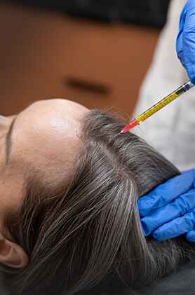 PRP treatment, growth factor therapy, skin and hair rejuvenation, Anudhi Clinic, Chennai