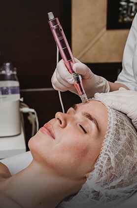 Microneedling radiofrequency, skin tightening, wrinkle reduction, Anudhi Clinic, Chennai