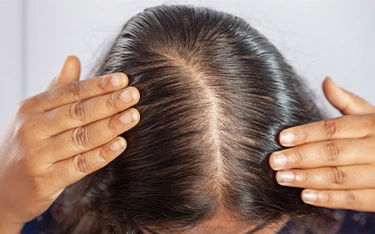 Hair fall tips in chennai