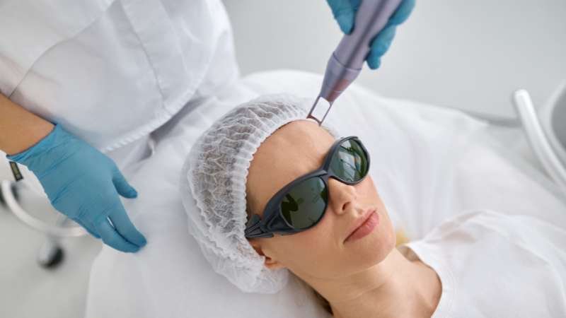 laser-hair-reduction-in-chennai