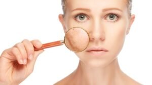 Pigmentation Treatment in Chennai – How to Get Even-Toned Skin