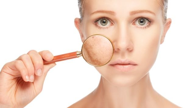 pigmentation treatment in chennai