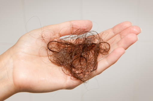 hair fall treatment in Chennai
